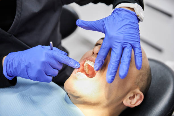 Best Chipped Tooth Repair Near Me  in Bella Vista, CA