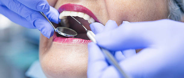 Best Chipped Tooth Repair Near Me  in Bella Vista, CA